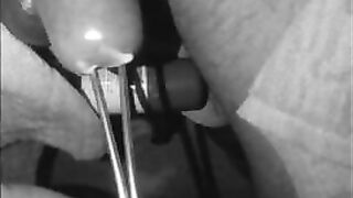 urethral incert with strainer