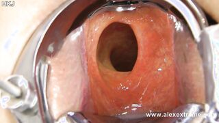 Incredible deep anal view with XO speculum and light in Hotkinkyjo ass