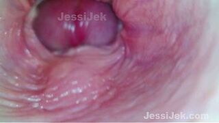 Dream babe got Twice Creampie Endoscope inside showed Extreme Fuck JessiJek